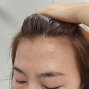 뮤리나 여성 탈모 앰플 M자 탈모초기 두피케어방법