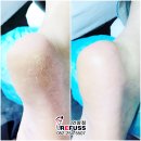 레푸스 앤 쓰담네일 이미지