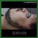 스노우의원대전둔산 이미지