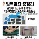 🦶 발목염좌 원인부터 증상, 진단검사, 족부교정치료(교정깔창, 도수치료, 재활운동), 후기까지 총정리