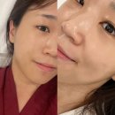 더셀럽 | [삼성동 피부관리] 미더베스트 대치점에서 셀럽케어 받고 온 후기 | 삼성동 맞춤형 피부관리