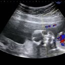 16-16-01 | 임신 16주 초음파 후기｜아기 얼굴 윤곽 보이기 시작한 16주 차 기록