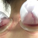 장산부부한의원 이미지