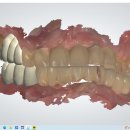 장치과기공소 이미지