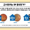 봄,안경 이미지