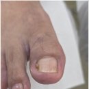 베어네일(Bear nail) | 진주내성발톱 아픔 없고 효과좋았던 후네일&amp;베어진주장대점