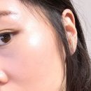 스킨트리 | 나이 거꾸로 먹는 비결? 저속노화 스킨부스터 시크릿 한남동피부과 트리필 프로 콜라쥬시술 후기