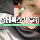 부산 쥬베룩 스킨 인라이튼 모공레이저 리얼후기 효과 및 통증