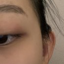 분당서울안과의원 이미지