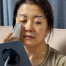 마데카프라임 사용 후기 예비신부의 홈케어 루틴템, 얼굴부터 바디까지 뷰티디바이스