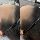 이미지헤어라인 이미지