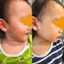 771020 | 더마 닥터 이칭 릴리프 100ml 영상/제품후기