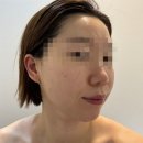 고은어린이집 | 인천 송도 윤곽관리 맛집 고은결에스테틱 페이스라인 리프팅 관리 추천 후기