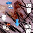 장애인친화미용실 공릉점 | 분당 미금역 미용실 추천! 메이원헤어 미금점 두피 클리닉 후기 (w/ 교수 부원장님, 이벤트, 쿠폰)