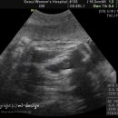 PC복댕이 이미지