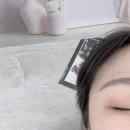 진메디텍 | 고주파 리프팅 종류 가장 효과 본 방법 후기!