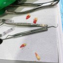 김동현치과의원 | [교정일기] 안녕, 잘가...🦷🦷🦷