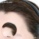 선헤어라인 이미지