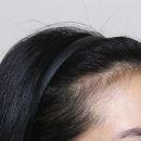 도화동공원 | 도화동두피문신, 시술 하고 안하고의 차이 진짜 클까?