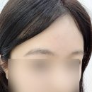 주연헤어라인 | [서울/강남]피씨엘코리아(PCL KOREA)ㅣ국내 페더링눈썹 전문가 주연원장님한테 받은 후기(통증X, 대만족)