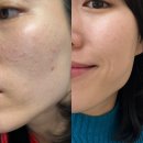 첨단기업로2L(2)-25 | 올리브영 인기템 달심클렌즈 주스 일주일 디톡스 찐후기