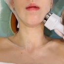 청담SKIN&BODY | 광주 용봉동 피부관리 ‘청담스킨앤스파’ LD소닉 이중턱 관리