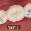 큐프라임부천치과의원 네이버블로그