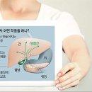 광화문약국] 간 피로 푸는 우루사 누구나 먹어도 될까 이미지