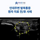 척척병원 | 인천 발목통증 병원 , 도화동 통증재활의학과 척척본의원 환자 치료 후기