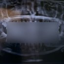 연세굿바이사랑니치과의원 이미지