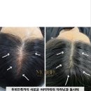 그로우모모 두피 탈모 케어센터 이미지