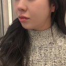 텐스탑 | 서면피부과 텐트리플 후기｜200샷으로 하이푸 600샷 효과 본 리얼 경험