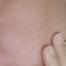 [다니에르 리뷰] 아르베라 피디알엔 리쥬샷 리페어 부스터 PDRN 후기