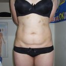 수파동테라피 이미지