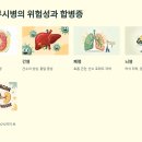 왕성세탁 | 쯔쯔가무시병 증상과 예방법 총정리