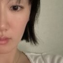 멍더가든 | 청담동 쥬베룩볼륨 멍 전후 효과 2회차 가격 후기