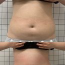 더치움 | 부산 사상 바디관리 루니움 에스테틱 후기 예신 복부관리 추천