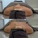기혈 순환 마사지 | &lt;여수 라온, 라움&gt; 여수피부체형관리 - 마사지로 1cm 줄어든 날