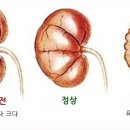 신장군집 이미지