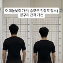 대구 세천유치원 건너 | [공지] 💃바레운동이란? 효과·장점·추천 대상 총정리｜대구 이곡동 더뷰필라테스 🩰✨