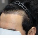 압구정모비앙의원 이미지