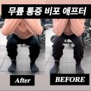 피에스솔루션 | 오리역PT 피티 무너진 하체 정렬을 잡는 운동 비포 애프터
