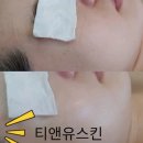 티앤유스킨