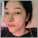 작은나무한의원 | 역삼안면비대칭 침 물리치료 추나요법 한의원 후기