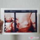 갤러리안경명지점 | 2022년 1월 임신20주에서 24주차 일상