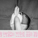 청진영양센타 | 귀여운 츄르 사냥꾼 스코티쉬 달이의 스트레스없는 빠른회복 암컷 중성화 수술 후기