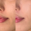 2026 애경서포터즈 뷰티클럽 프리미어 서포터즈 웰컴박스 언박싱 후기