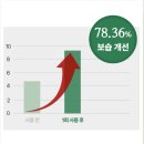 우리메딕스 | 엉덩이간지러움 안녕! 순한 포레메딕스임산부 항문세정제 &amp; 항문청결제사용법