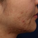 청담고운세상닥터지피부과의원 이미지