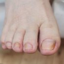 대전레푸스다솜네일 이미지